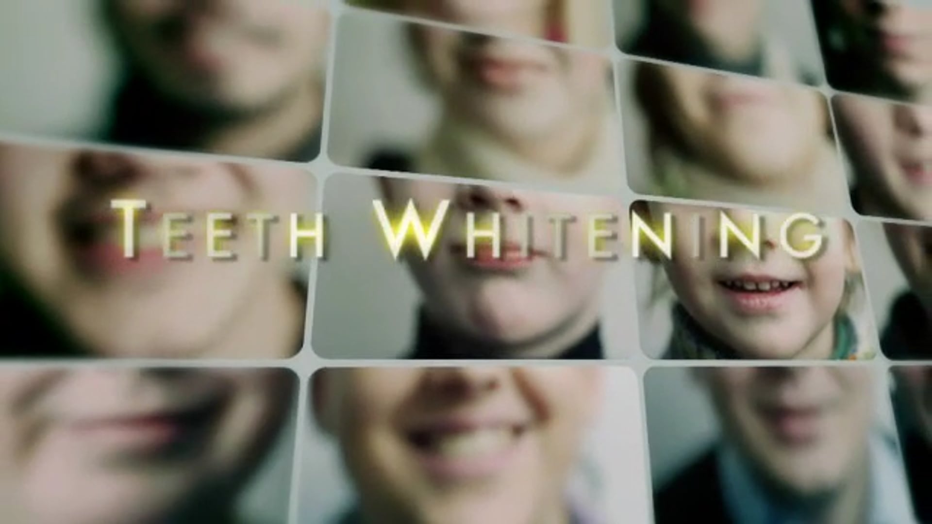 Procedure - Teeth Whitening